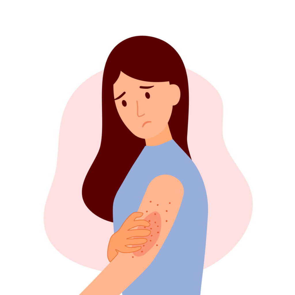 female suffering from strong allergy skin itchy symptom in flat design