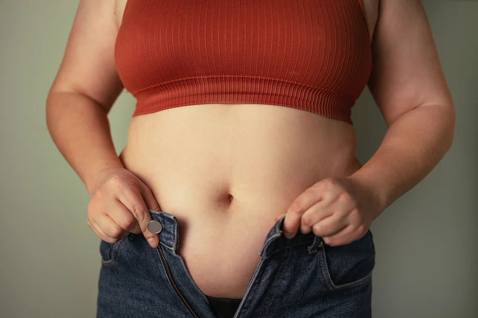 A Belly of an Obese Woman