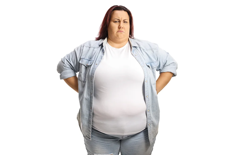 An Obese Woman