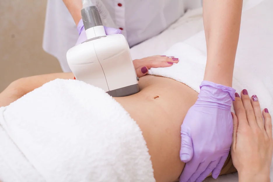 Coolsculpting Treatment on Stomach